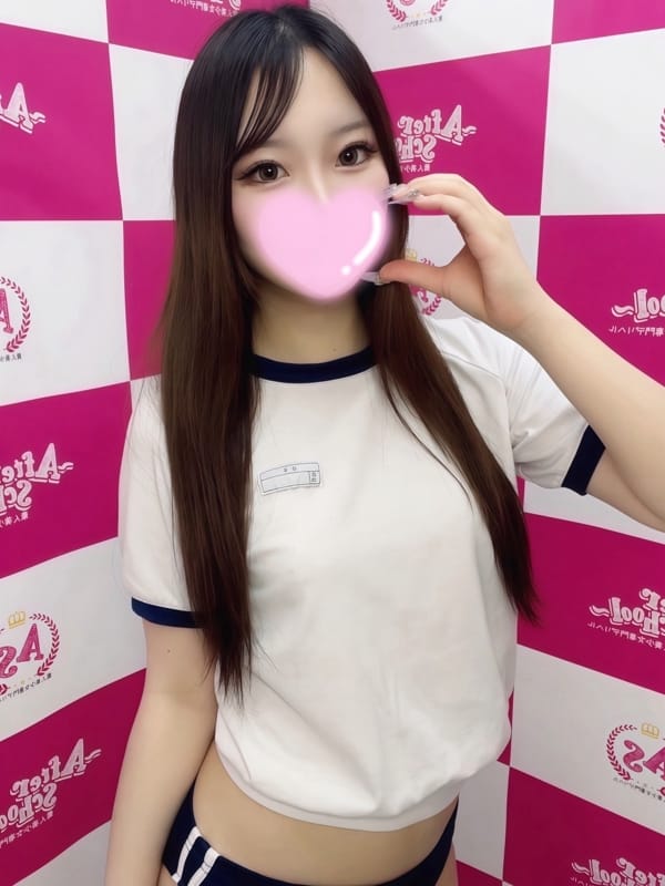 MIO